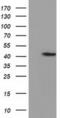 Phosphoribosyl Pyrophosphate Synthetase Associated Protein 2 antibody, MA5-25209, Invitrogen Antibodies, Western Blot image 
