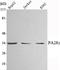 Proteasome Activator Subunit 3 antibody, A04375, Boster Biological Technology, Western Blot image 