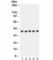 Snail Family Transcriptional Repressor 1 antibody, R31852, NSJ Bioreagents, Western Blot image 