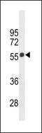 Cannabinoid Receptor 1 antibody, LS-C157604, Lifespan Biosciences, Western Blot image 