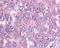 Baculoviral IAP Repeat Containing 5 antibody, NB500-205, Novus Biologicals, Immunohistochemistry paraffin image 