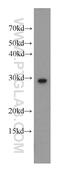 Uroporphyrinogen III Synthase antibody, 14913-1-AP, Proteintech Group, Western Blot image 