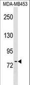 Protein O-Mannosyltransferase 2 antibody, LS-C158699, Lifespan Biosciences, Western Blot image 