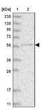 CDP-Diacylglycerol Synthase 1 antibody, NBP1-85894, Novus Biologicals, Western Blot image 