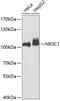 Nuclear Receptor Subfamily 3 Group C Member 1 antibody, 15-135, ProSci, Western Blot image 