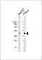 Alanine--Glyoxylate And Serine--Pyruvate Aminotransferase antibody, M02267, Boster Biological Technology, Western Blot image 