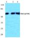 Checkpoint Kinase 2 antibody, A00277T68, Boster Biological Technology, Western Blot image 