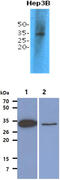 Thiopurine S-Methyltransferase antibody, MBS200217, MyBioSource, Western Blot image 