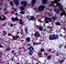 Phosphofructokinase, Muscle antibody, LS-C101264, Lifespan Biosciences, Immunohistochemistry paraffin image 