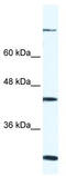 FYVE, RhoGEF And PH Domain Containing 1 antibody, TA329379, Origene, Western Blot image 