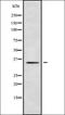 Phospholipid Scramblase 2 antibody, orb338551, Biorbyt, Western Blot image 