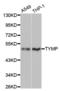 Thymidine Phosphorylase antibody, A1094, ABclonal Technology, Western Blot image 