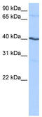 Casein Kinase 1 Gamma 2 antibody, TA340010, Origene, Western Blot image 