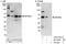 Zinc Finger And BTB Domain Containing 8A antibody, A303-241A, Bethyl Labs, Western Blot image 