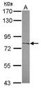 Carboxypeptidase X, M14 Family Member 2 antibody, PA5-31412, Invitrogen Antibodies, Western Blot image 