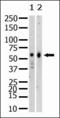 Lysine Methyltransferase 5A antibody, MA5-11140, Invitrogen Antibodies, Western Blot image 