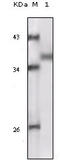 Ribosomal Protein S6 Kinase A1 antibody, M01058, Boster Biological Technology, Western Blot image 