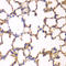 Erythrocyte Membrane Protein Band 4.1 antibody, STJ114308, St John