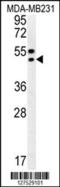 Translocation Associated Membrane Protein 2 antibody, 62-128, ProSci, Western Blot image 