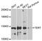 Telomerase Reverse Transcriptase antibody, MBS127613, MyBioSource, Western Blot image 
