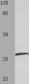 LPA4 antibody, TA321701, Origene, Western Blot image 