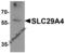 Solute Carrier Family 29 Member 4 antibody, 8131, ProSci, Western Blot image 