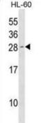 Cyclin Dependent Kinase Inhibitor 1B antibody, abx030436, Abbexa, Western Blot image 