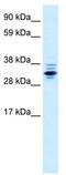 Zinc Finger Protein 654 antibody, TA331868, Origene, Western Blot image 