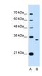 NDRG Family Member 2 antibody, NBP1-55431, Novus Biologicals, Western Blot image 