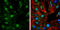Protein Tyrosine Kinase 2 antibody, GTX132320, GeneTex, Immunocytochemistry image 