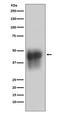 CD46 Molecule antibody, M00377-1, Boster Biological Technology, Western Blot image 