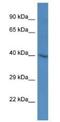 SH3 Domain Containing GRB2 Like 3, Endophilin A3 antibody, NBP1-79630, Novus Biologicals, Western Blot image 