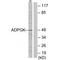 ADP Dependent Glucokinase antibody, A10813, Boster Biological Technology, Western Blot image 