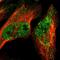 TRNA Methyltransferase 12 Homolog antibody, PA5-54935, Invitrogen Antibodies, Immunofluorescence image 