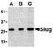 Snail Family Transcriptional Repressor 2 antibody, AP05600PU-N, Origene, Western Blot image 