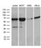 Activin A Receptor Like Type 1 antibody, LS-C799654, Lifespan Biosciences, Western Blot image 