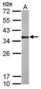 Thiosulfate Sulfurtransferase antibody, TA308433, Origene, Western Blot image 