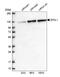 Spindle Apparatus Coiled-Coil Protein 1 antibody, NBP2-47517, Novus Biologicals, Western Blot image 