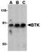 Bruton Tyrosine Kinase antibody, orb74569, Biorbyt, Western Blot image 