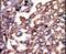 Protein Kinase CAMP-Dependent Type I Regulatory Subunit Alpha antibody, PA5-15368, Invitrogen Antibodies, Immunohistochemistry paraffin image 