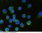 CD276 Molecule antibody, 11188-MM06, Sino Biological, Immunohistochemistry frozen image 