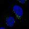 Golgi Reassembly Stacking Protein 2 antibody, NBP2-36779, Novus Biologicals, Immunocytochemistry image 