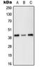 Protein Kinase X-Linked antibody, orb214460, Biorbyt, Western Blot image 