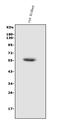 Hexosaminidase Subunit Alpha antibody, A00692, Boster Biological Technology, Western Blot image 