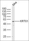 Keratin 81 antibody, orb317643, Biorbyt, Western Blot image 