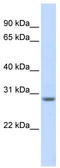 RING finger protein 178 antibody, TA330501, Origene, Western Blot image 