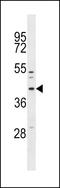 Mitochondrial Fission Factor antibody, LS-C158137, Lifespan Biosciences, Western Blot image 