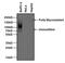 Carcinoembryonic Antigen Related Cell Adhesion Molecule 1 antibody, MA5-14675, Invitrogen Antibodies, Western Blot image 