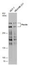 Plectin antibody, GTX130764, GeneTex, Western Blot image 