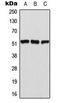 Activating Transcription Factor 2 antibody, LS-C353953, Lifespan Biosciences, Western Blot image 